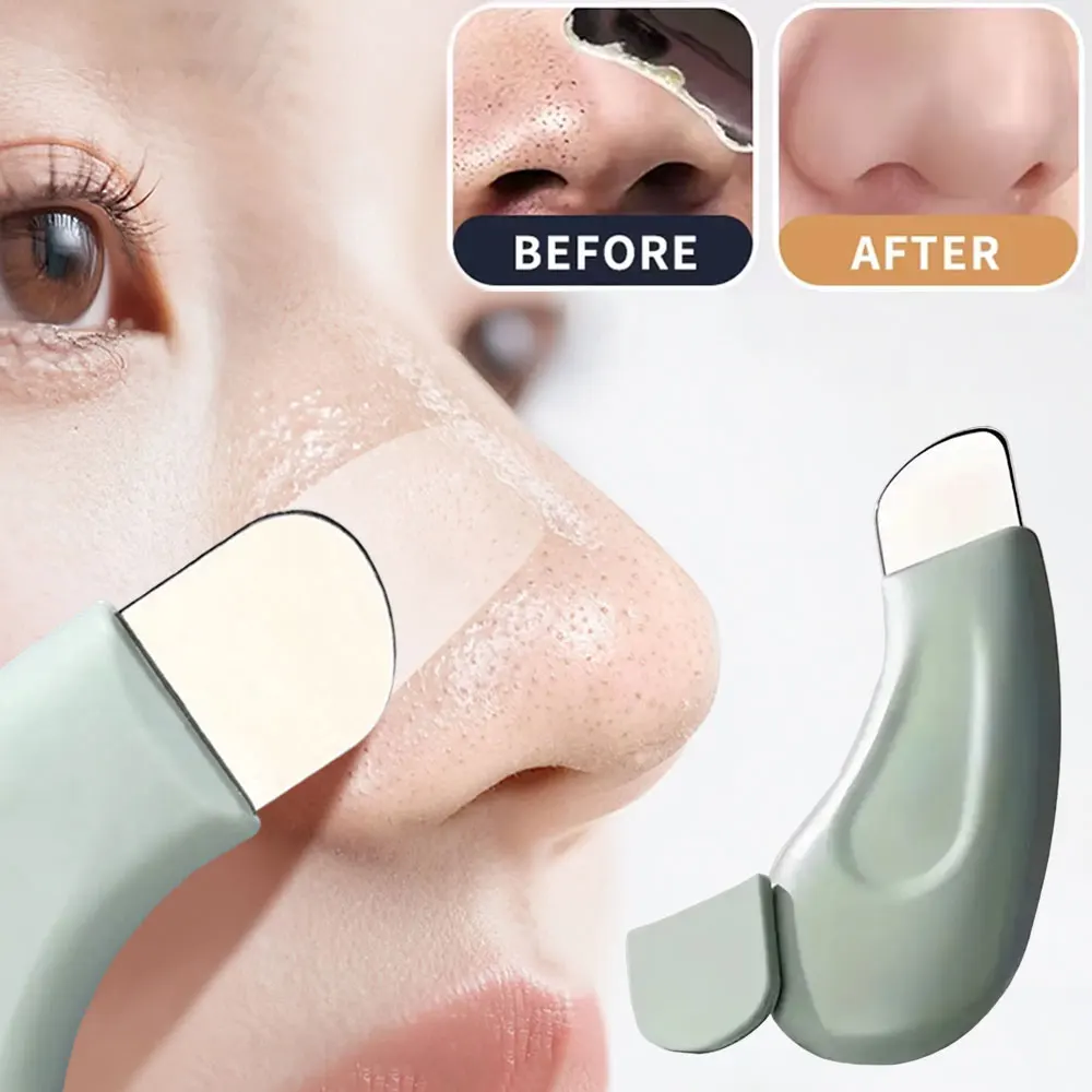 Narzędzie do usuwania zaskórni – Nasal Aspirator recenzja i cena